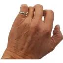 bague-acupression-anti-ronflement.webp