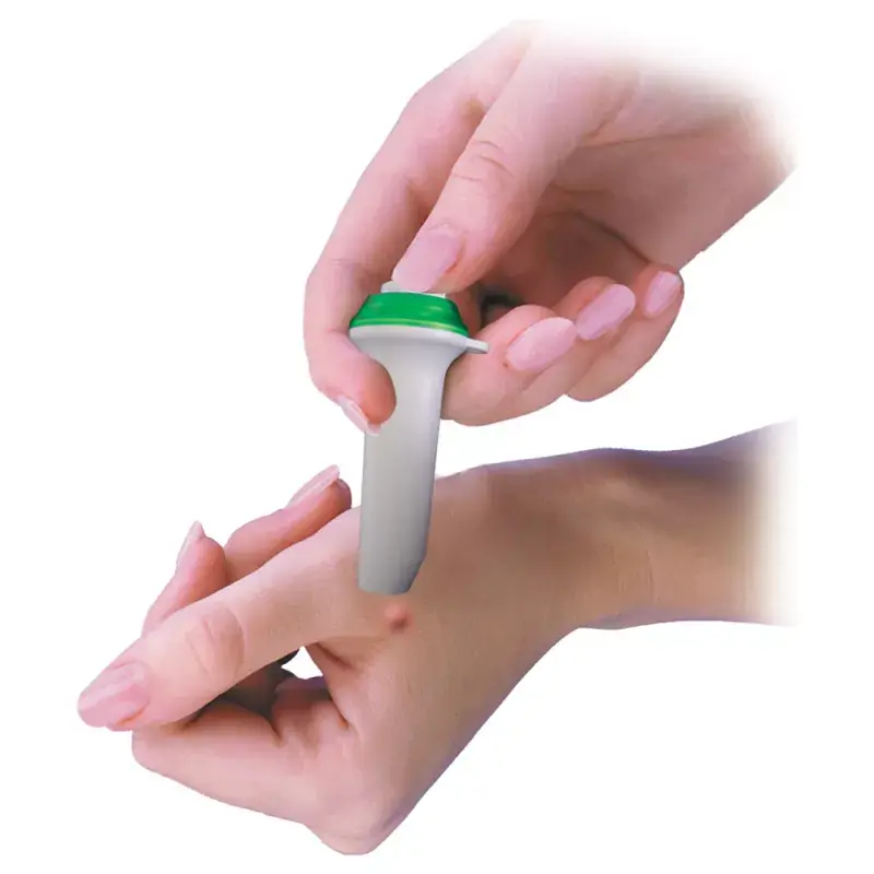 Mosquito-click : soin après piqûre sans produit chimique et sans pile